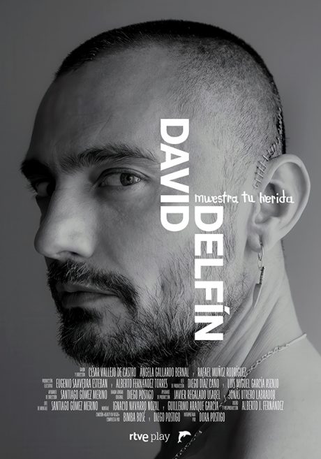 Cartel de David Delfín. Muestra tu herida